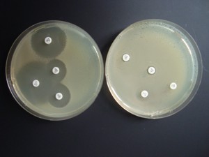 Example of a susceptibility test to different antibiotics, an antibiogram
