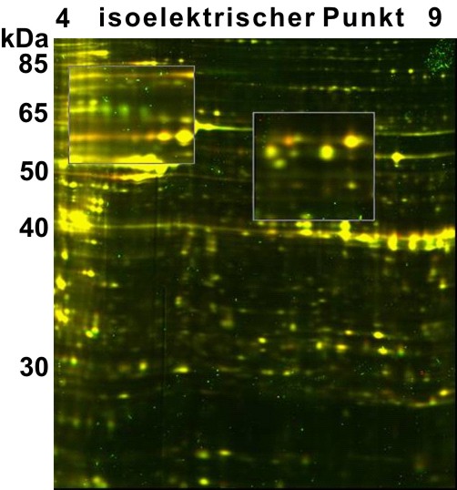 2D Gel