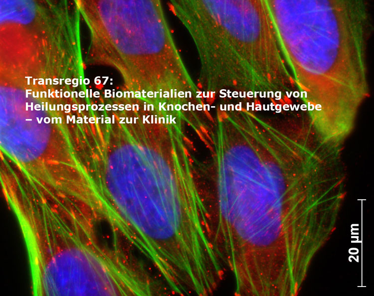 Quelle: http://www.uni-leipzig.de/~trr67/joomla/