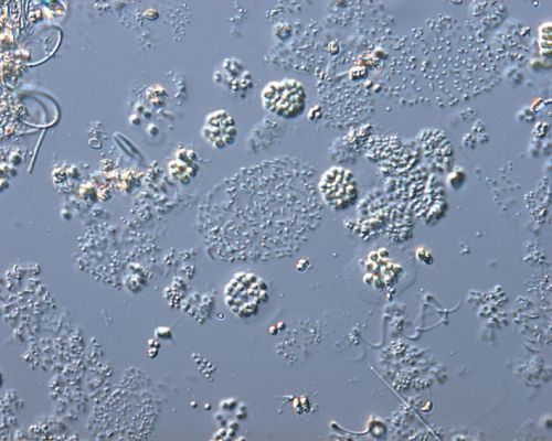 Diese 30-50 µm großen Cyanobakterien-Kolonien gehören zu den Chroococcales und zum Synechococcales Clade C1. Diese Artenzusammensetzung unterscheidet sich signifikant von den sonst in limnischen und marinen Systemen dominierenden Cyanobakterienblüten. Foto: Rhena Schumann