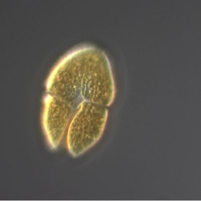 Akashiwo sanguinea, ein häufig im Herbst um Helgoland vorkommender Dinoflagellat