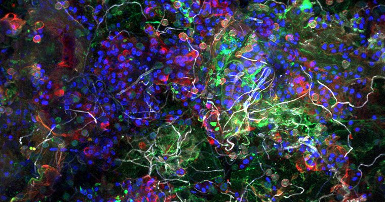 plastisphere ©Dr Thomas Neu / UFZ