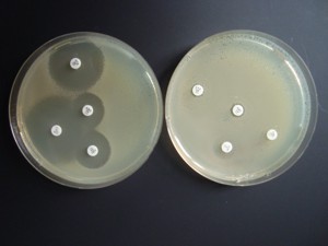 Beispiel für Antibiotikatests (Antibiogramm) Beispiel für Antibiotikatests (Antibiogramm)