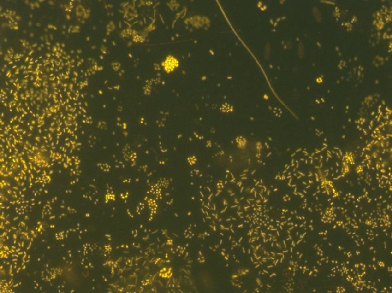 Cyanobakterien Cyanobakterien