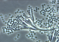 Penicillium chrysogenum Penicillium chrysogenum