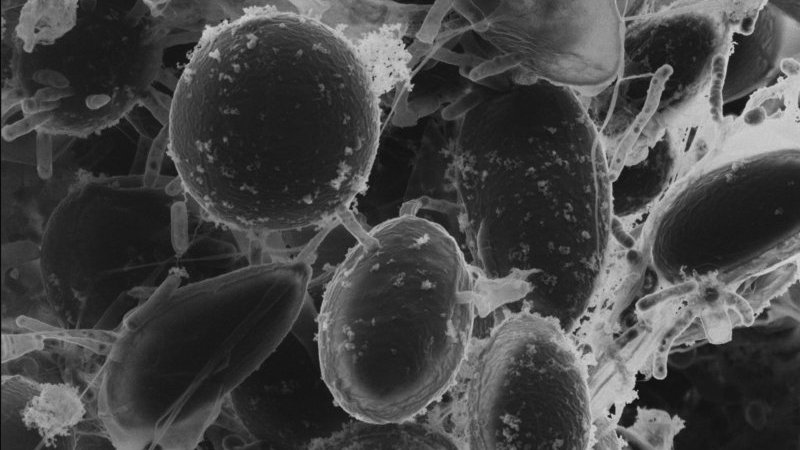 helium-ion-micrograph of a microalgae biofilm