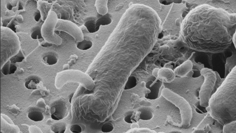 helium-ion-micrograph of an E.coli infected by a Bdellovibrio bacteriovorus