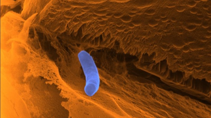 helium-ion micrograph of an iron-oxidising bacterium on a sediment