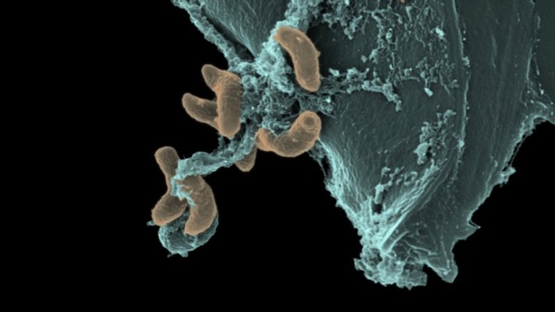 helium-ion micrograph of nitrogen-fixing bacteria in a root-nodule