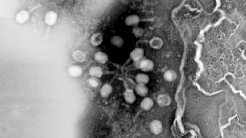 scanning transmission electron micrograph of T4 bacteriophages