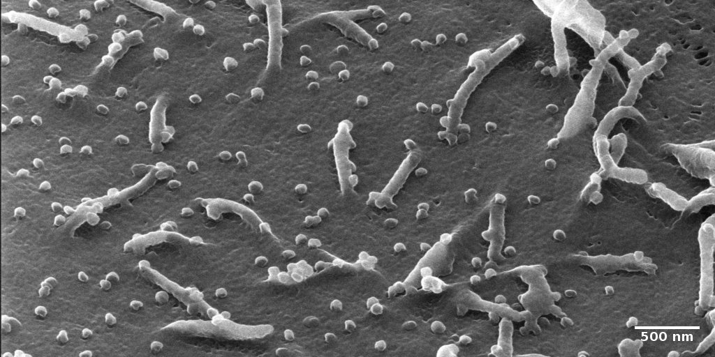 Helium-ion micrograph of a vero cell infected with Sars-CoV2 virusses.
Sample: Prof. Dr. Uwe G. Liebert, Universität Leipzig. Image: Dr. Matthias Schmidt, ProVIS, UFZ.