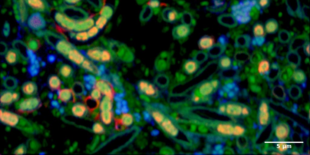 Carbon (red) and nitrogen (blue) assimilation activity in a microbial biofilm (green) visualised by nanoSIMS.
Sample: Dr. Kim Milferstedt. Image: Dr. Hryhoriy Stryhanyuk, ProVIS, UFZ.