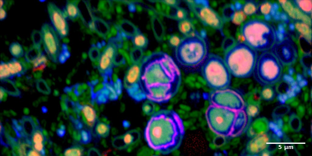 Tracing freshly-assimilated carbon (red) and nitrogen (blue) in a micro-algal biofilm with nanoSIMS.
Sample: Dr. Kim Milferstedt. Image: Dr. Hryhoriy Stryhanyuk, ProVIS, UFZ.