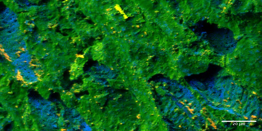 TiOx (yellow) and Ti (blue) in calcinated guava seed as seen by ToF-SIMS.
Sample: Dr. María P. Elizalde (BUAP, Mexico). Image: Dr. Hryhoriy Stryhanyuk, ProVIS, UFZ.