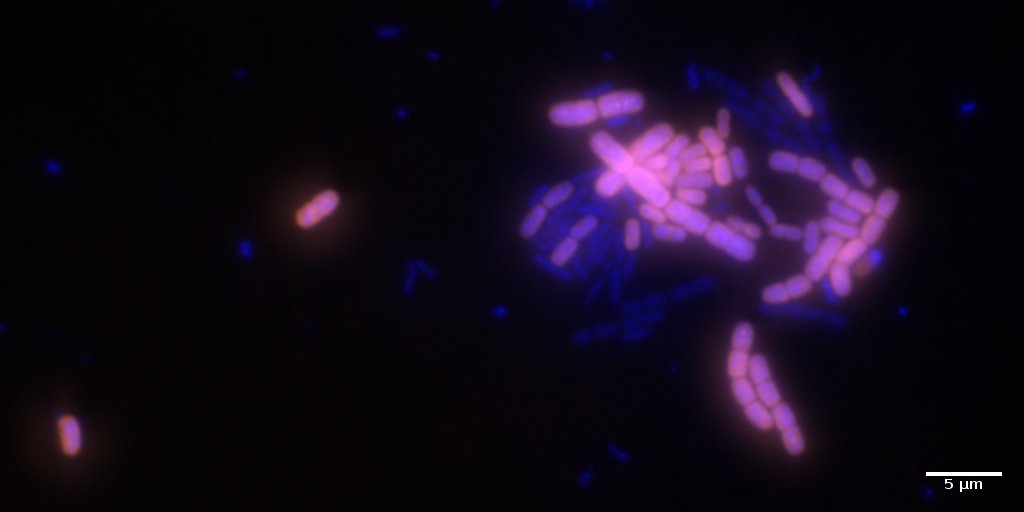 Fluorescense in-situ hybridisation image of Acinetobacter spp. surviving high concentrations of antibiotics.
Sample and image: Dr. Niculina Musat, ProVIS, UFZ