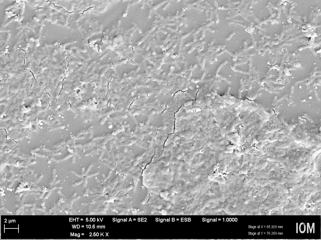 Scanning electron microscopy image of Pseudomonas sp. attached to a polyurethane polymer (Leibniz Institute of Surface Engineering, IOM, Leipzig, © Christian Eberlein, Hermann Heipieper).