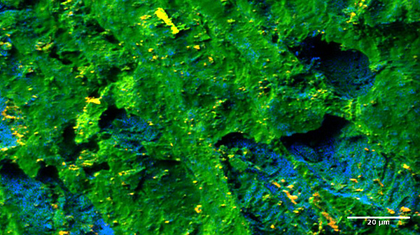 TiOx (yellow) and Ti (blue) in calcinated guava seed as seen by ToF-SIMS. Sample: Dr. María P. Elizalde (BUAP, Mexico). Image: Dr. Hryhoriy Stryhanyuk, ProVIS, UFZ.