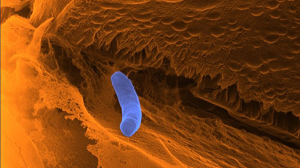 Helium-ion micrograph of an iron-oxidising bacterium on a sediment  © Dr. Matthias Schmidt / UFZ