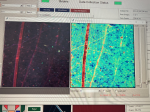 Mapping Zn in soils and roots