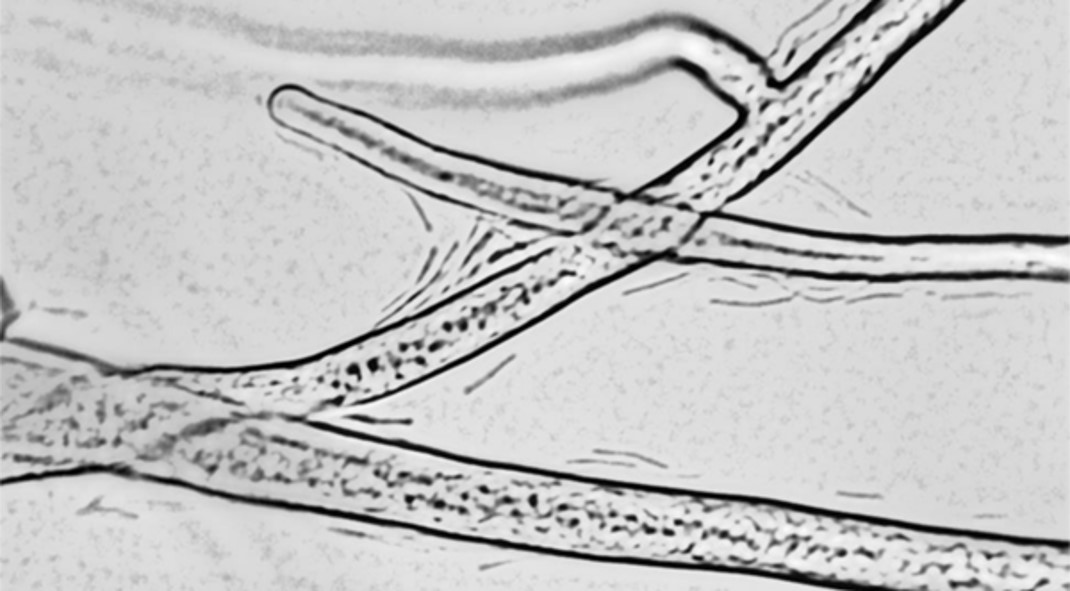 'Fungal pipeline' - Hyphae sustain the growth of bacteria in the hyphosphere by cytoplasmic streaming and release of nutrients 
(© Anja Worrich/UFZ)