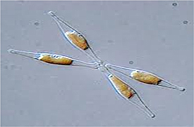 Microscopical picture of a diatom(<i>Phaeodactylum-tricornutum</i>), Source: Leipzig Univerity