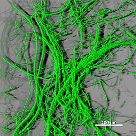 Image of the soil fungi Fusarium oxysporum Image of the soil fungi Fusarium oxysporum