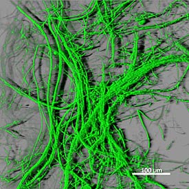 Aufnahme des Bodenpilzes Fusarium oxysporum per Laser Scanning Mikroskopie