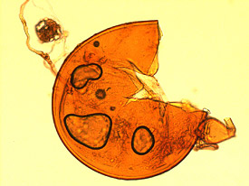 Mikroskopische Darstellung der zerbrochenen Spore eines arbuskulären Mykorrhizapilzes aus der Gattung Gigaspora