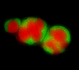 Anaerobes Methanoxidierer-Konsortium