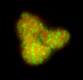 Anaerobes Methanoxidierer-Konsortium Anaerobes Methanoxidierer-Konsortium