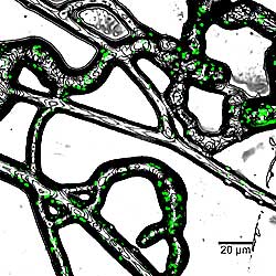Bacteria on a mycelium Bacteria on a mycelium