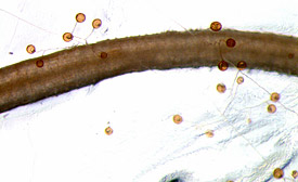 Die arbuskuläre Mykorrhiza. Pilzmyzel und Sporen um eine Wurzel