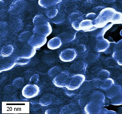 Nanoparticles shown by a raster-electron microscope  photo: UFZ