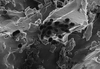Aquifer Bacteria Aquifer Bacteria