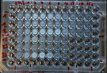 Microtiterplate with bacterial communities Microtiterplate with bacterial communities