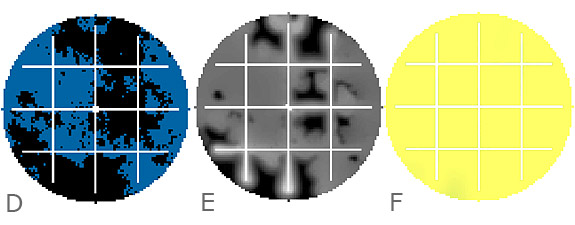 Simulation der Ausbreitung von Bakterien mit einem Netzwerk