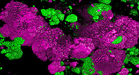 Bakterien der Gattung Nitrospira. Foto: Holger Daims Bakterien der Gattung Nitrospira. Foto: Holger Daims