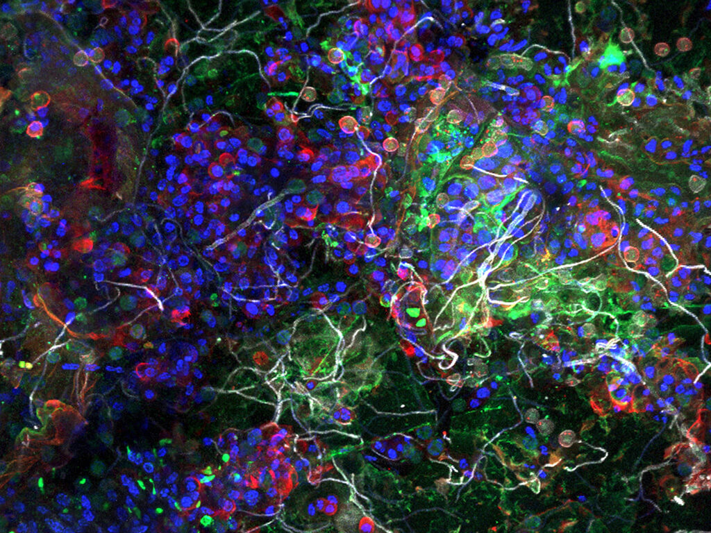 Plastisphere ©Dr Thomas Neu/UFZ